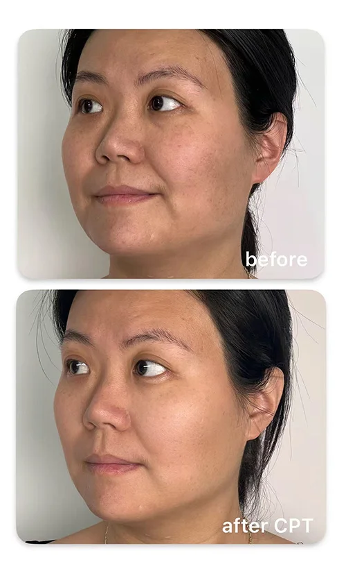 skin treatments skin treatments