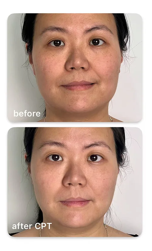 specialist face treatments specialist face treatments